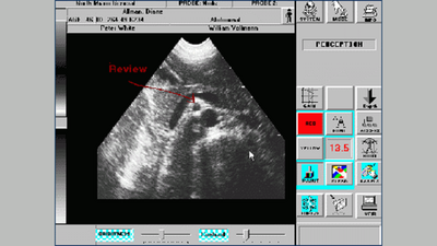 PC technology ultrasound interface