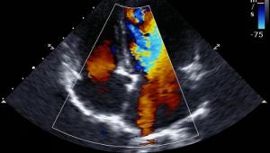 PC technology builds better ultrasound